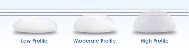 Side-by-side comparison of the height, or projection, of low profile, moderate profile, and high profile breast implants.