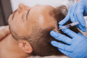 PRP Hair loss therapy in Westchester County