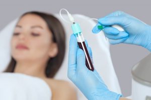 PRP microneedling in Westchester County